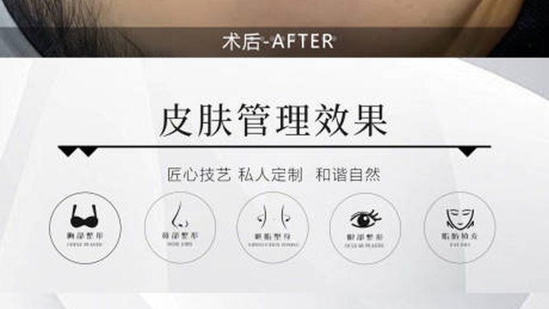 玻尿酸OEM，揭秘最小起订量的关键因素
