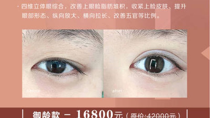 玻尿酸精华液代理：揭秘参数背后的注意事项**