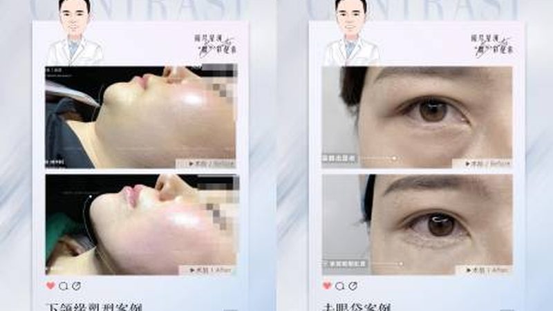 皮肤管理加盟开店，费用明细揭秘