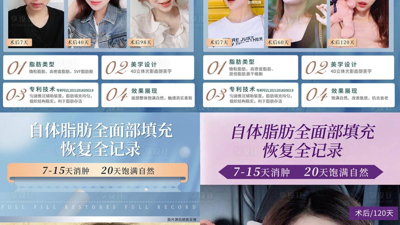 小标题：肉毒素注射效果的影响因素
