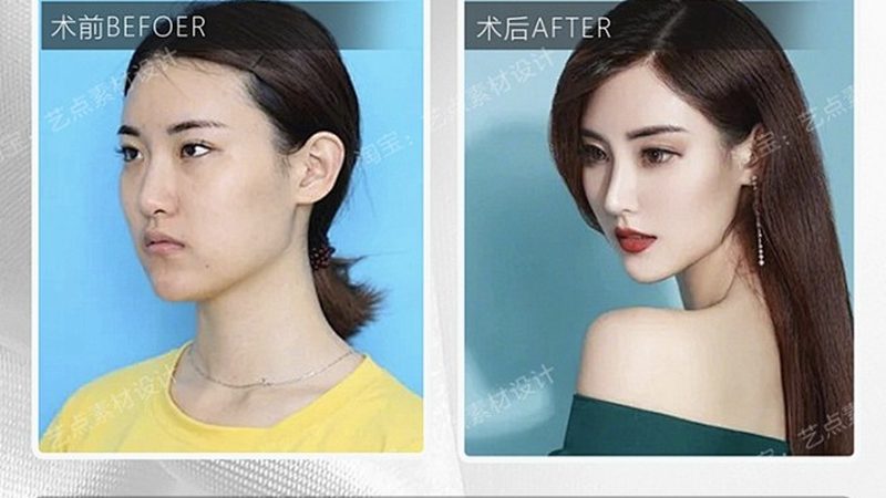 水光针批发一手货源，揭秘行业供应链真相