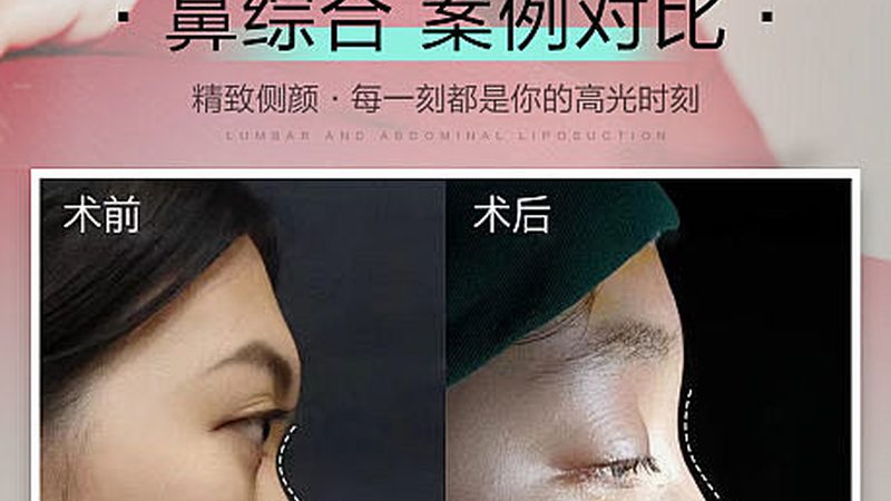 上海瘦脸按摩棒：如何挑选适合自己的按摩神器**