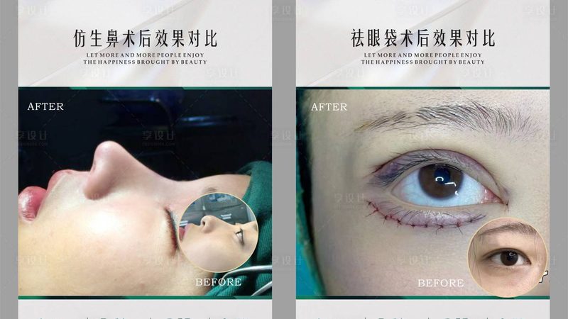 干皮抗衰面霜：揭秘成分与选择技巧