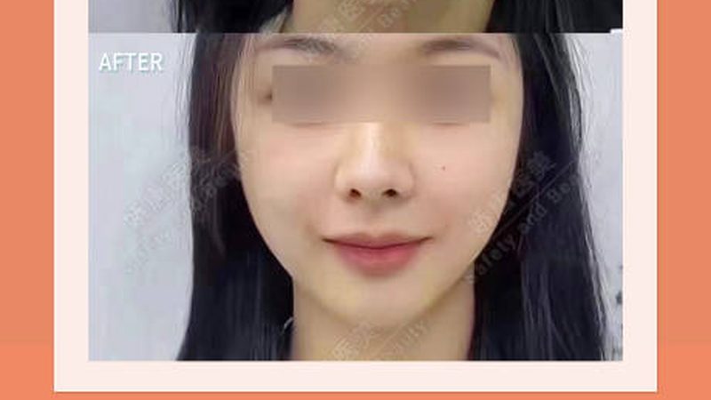 皮肤管理中心线上推广预算多少
