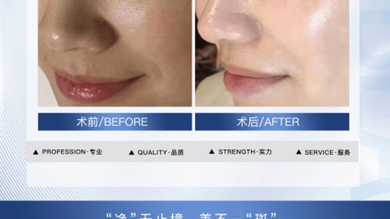 家用超声炮：揭秘其原理与选购要点