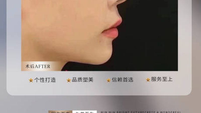 玻尿酸面膜能天天用吗