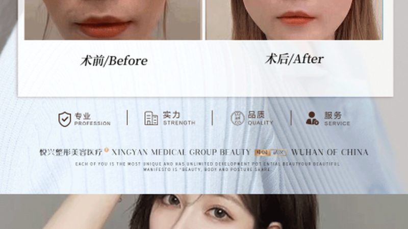 北京海淀区水光针，揭秘其魅力与选择要点