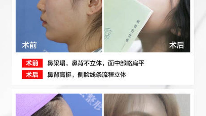 岁抗衰定制护肤方案：揭秘个性化护肤之道
