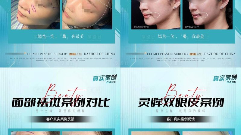 轻医美与生美区别百科