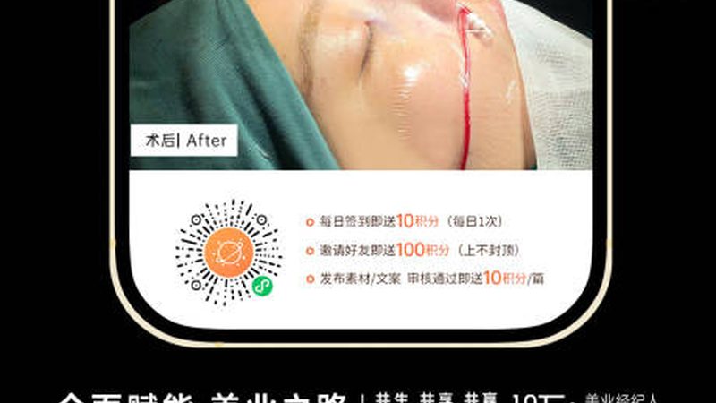 比基尼激光脱毛后毛发变粗？揭秘原因及应对方法