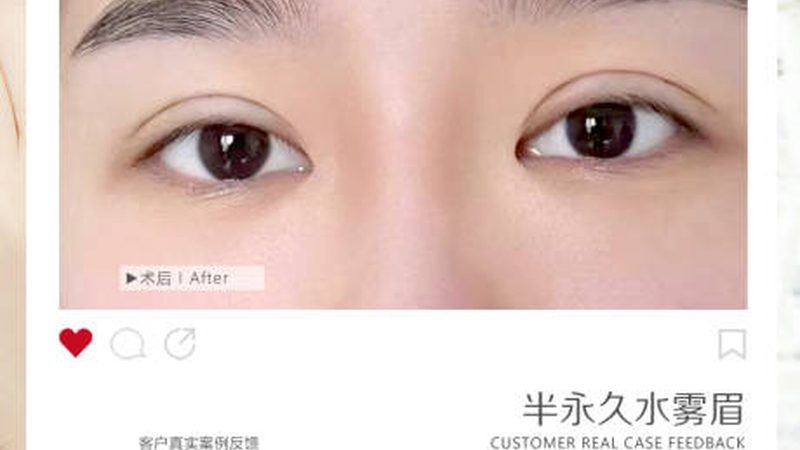 永久脱毛，真的有效吗？揭秘脱毛技术的真相**
