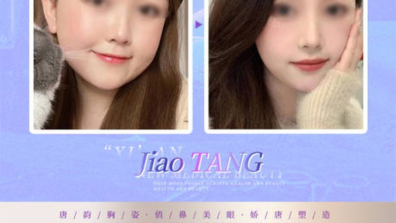 激光美容与光子嫩肤：流程解析与区别解读