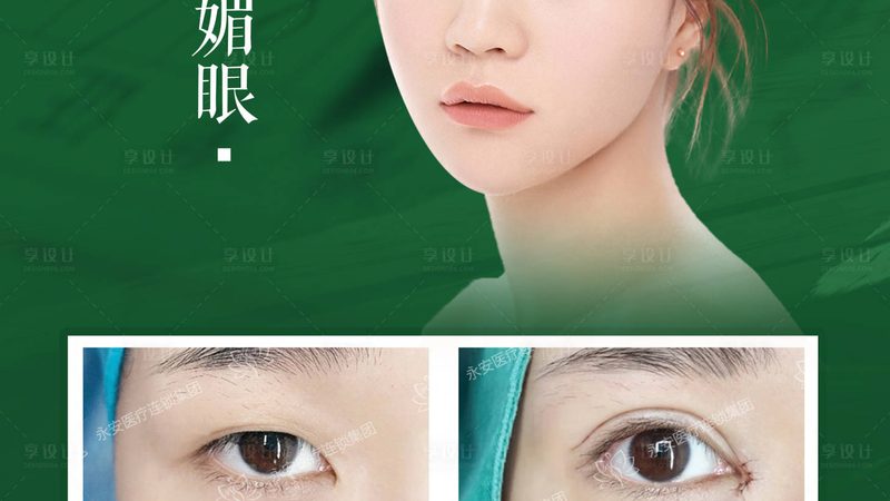 双眼皮贴松弛？揭秘双眼皮成型与修复之道