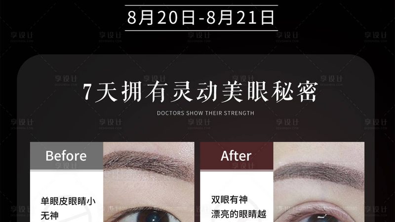 深圳激光祛黄褐斑正规医院推荐