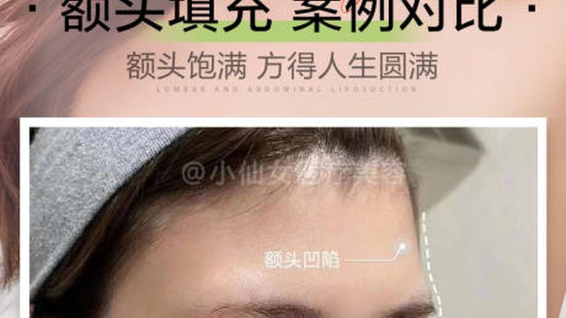 上海注射美容医院如何挑选？揭秘四大关键要素